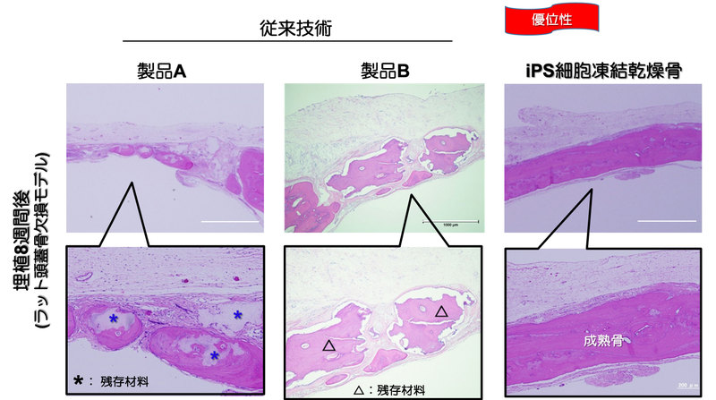 iPS Cell